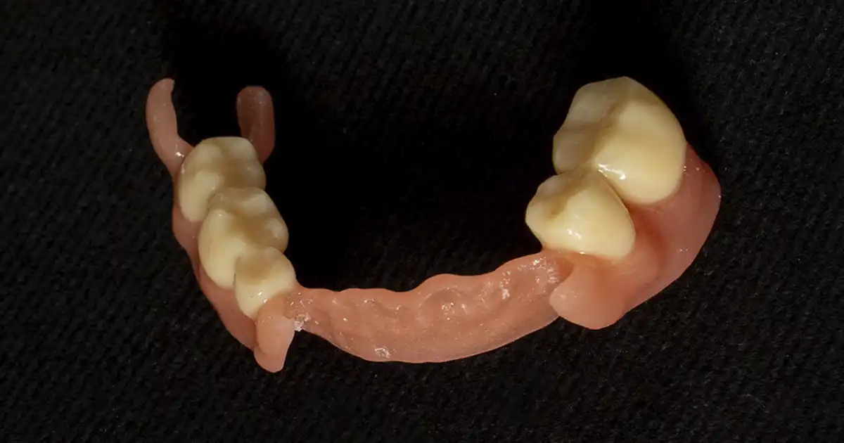 Prótesis removible dental, flexible digital